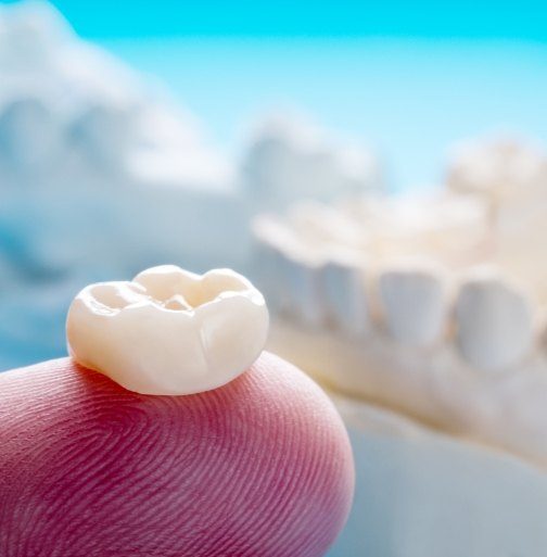 Dental crown restoration resting on a fingertip