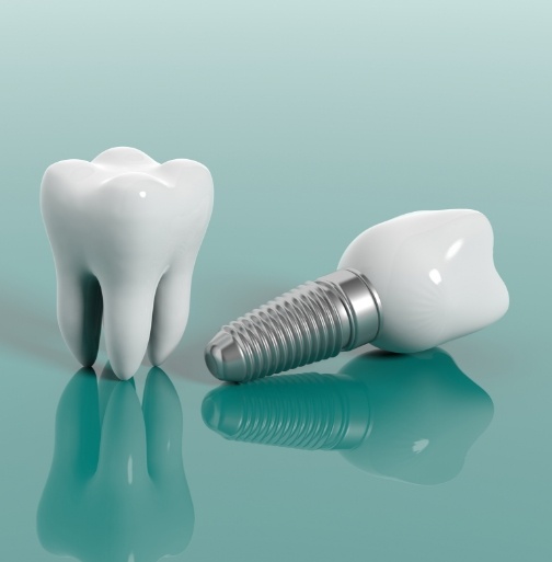 Animated natural tooth and dental implant supported replacement tooth