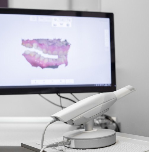 Digital dental impression system