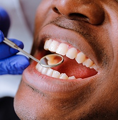 dentist in Newington checking patient’s mouth