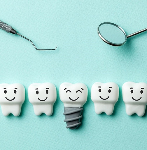 Illustration of dental implant in Newington