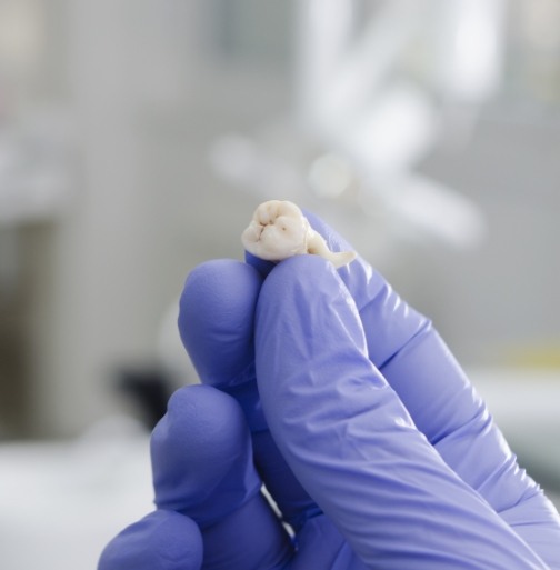 Hand holding an extracted tooth