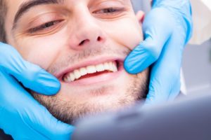 Close up of man smiling during his dental visit